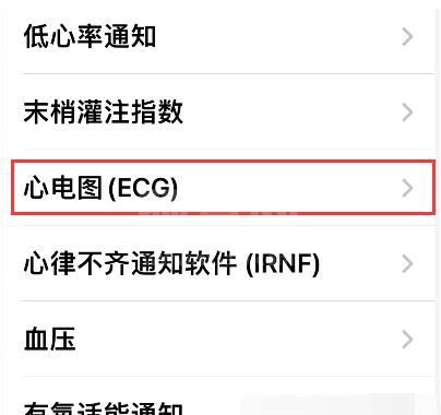 AppleWatch7怎么查看心电图数据？AppleWatch7心电图数据查看方法截图
