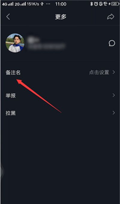 抖音修改关注的人备注名的方法步骤截图