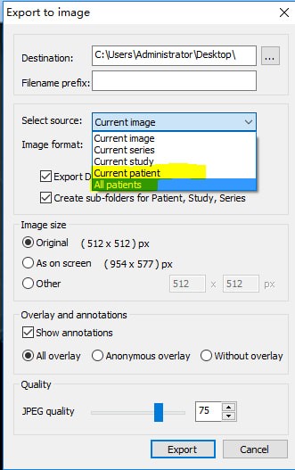 MicroDicom viewer(Dicom格式看图软件)