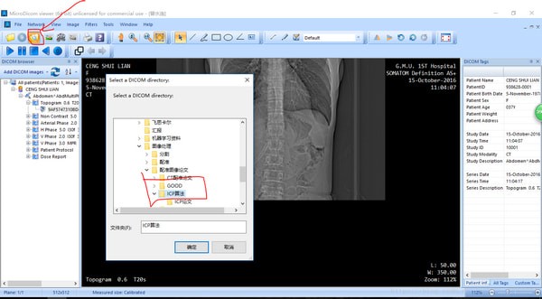 MicroDicom viewer(Dicom格式看图软件)