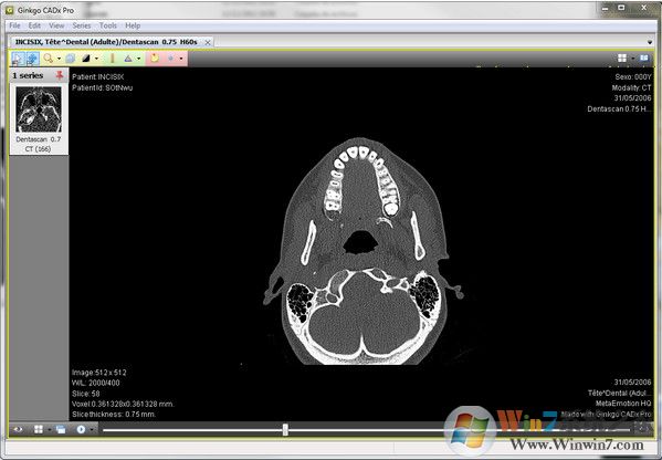 DICOM浏览器_Ginkgo CADx Pro(dicom看图软件)绿色版