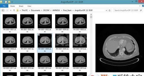 DICOM Thumbnailer(DICOM缩略图查看器)v1.10.5绿色版