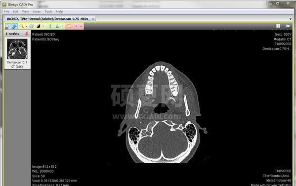 Ginkgo CADx Pro下载|医学影像查看软件 V3.7.1官方版
