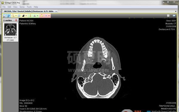 DICOM浏览器_Ginkgo CADx Pro(dicom看图软件)绿色版