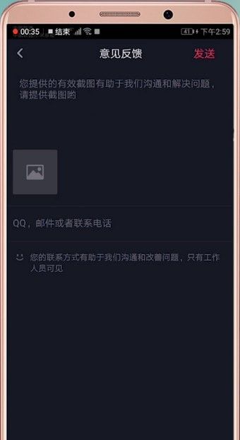 在抖音里联系客服的基础操作截图